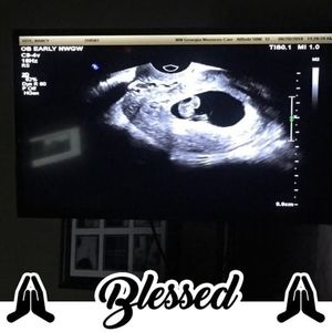 Meet your Posher, Randy